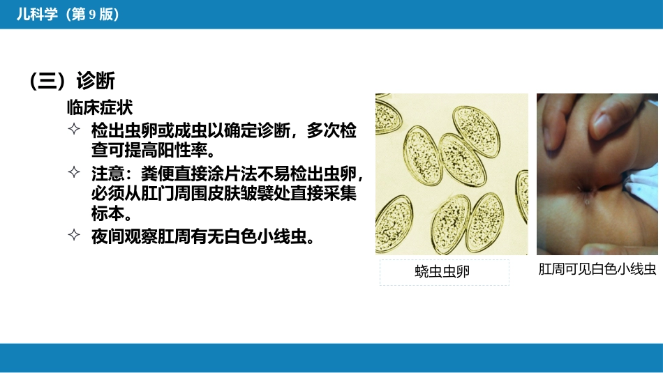 第八章 感染性疾病 第五节 寄生虫病_第11页