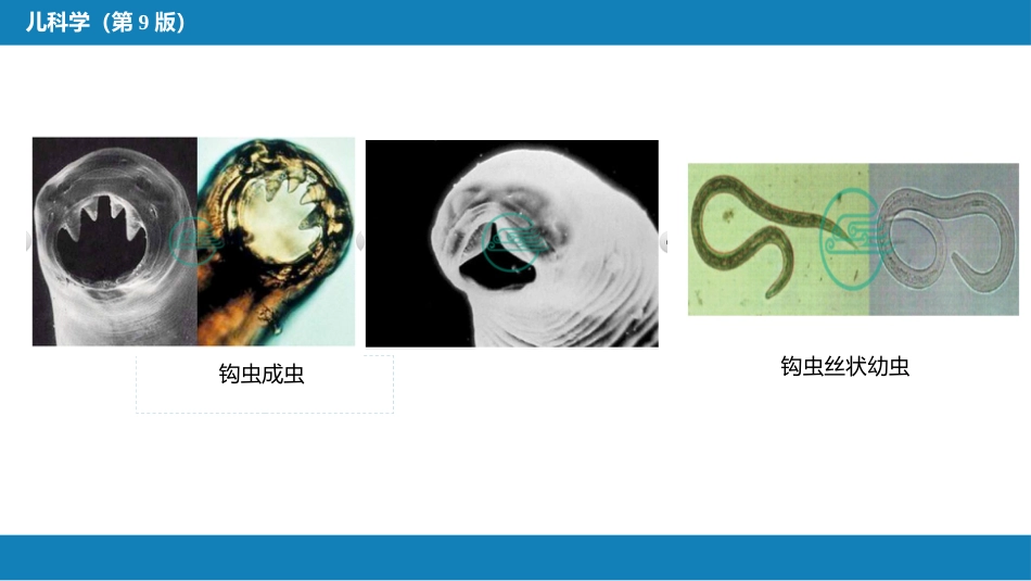 第八章 感染性疾病 第五节 寄生虫病_第14页