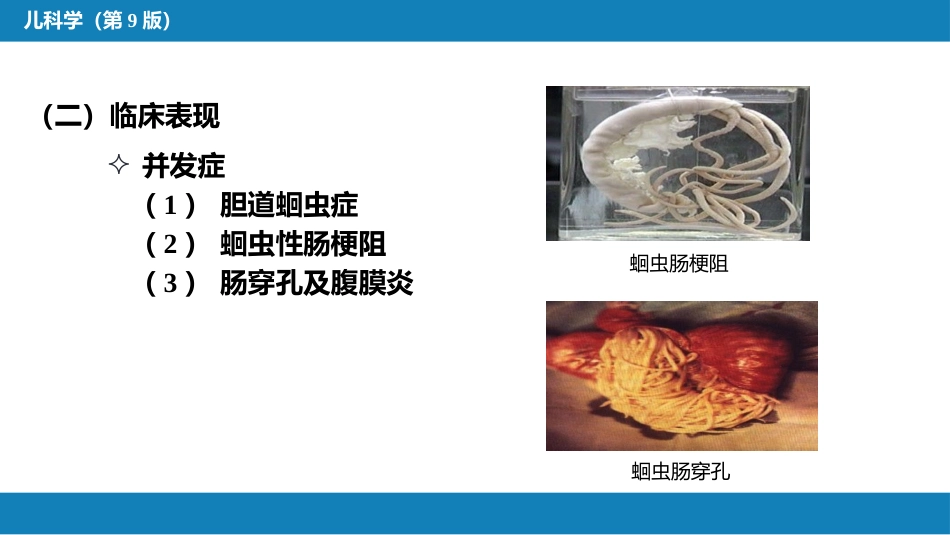 第八章 感染性疾病 第五节 寄生虫病_第6页