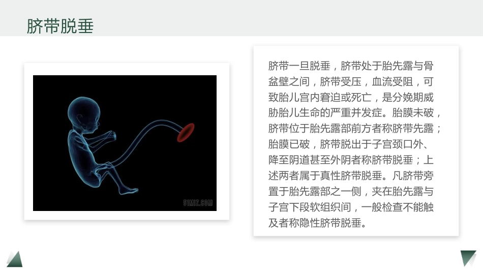 剖宫产术护理教学查房_第15页