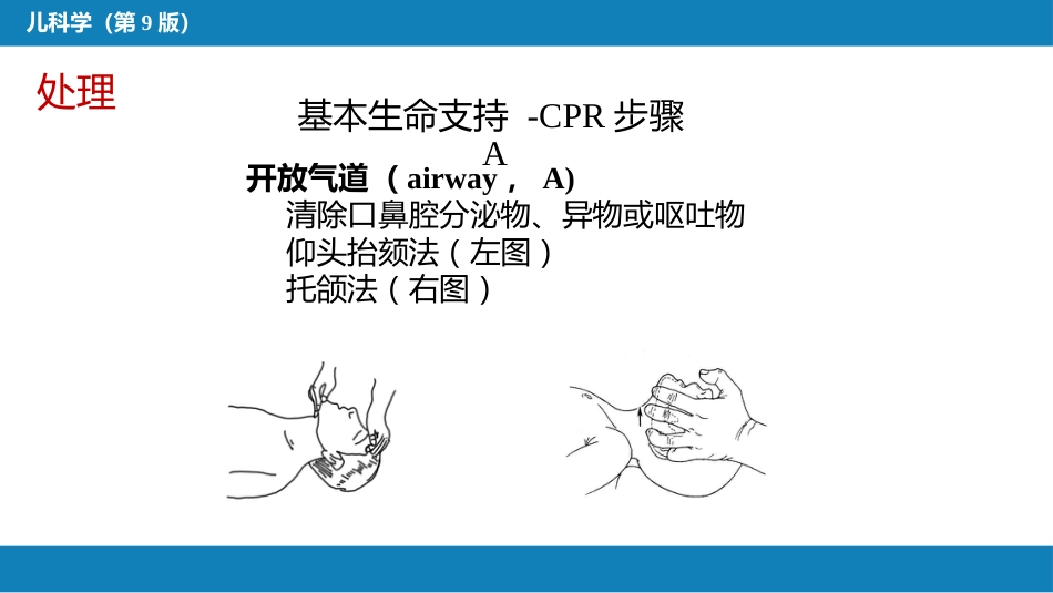 第十七章 儿童急救_第13页