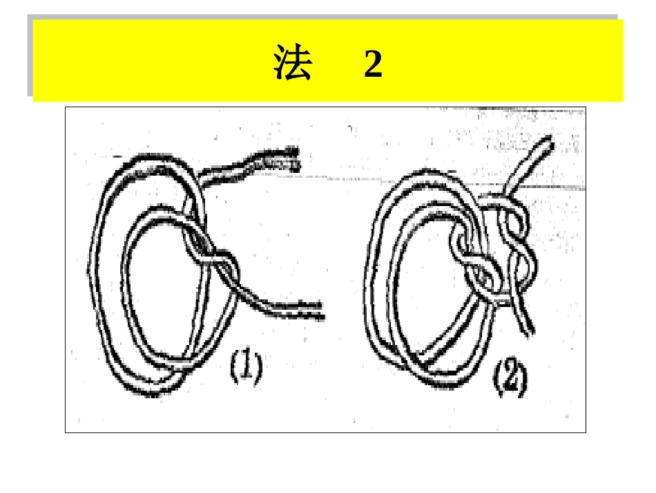 保护性约束_第14页