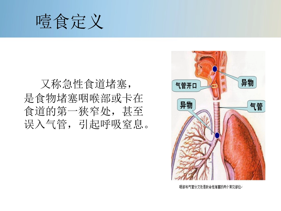 精神科护理技能 5.4 噎食防范与护理_第3页