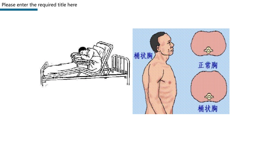 心力衰竭护理查房PPT模板_第12页