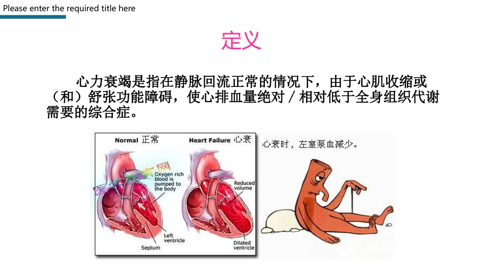 心力衰竭护理查房PPT模板_第3页
