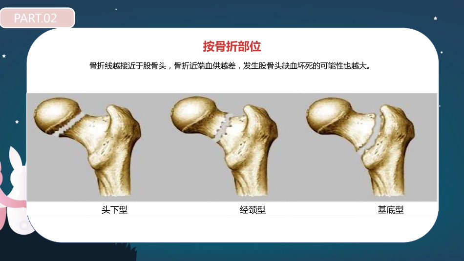 股骨胫骨折护理查房_第13页