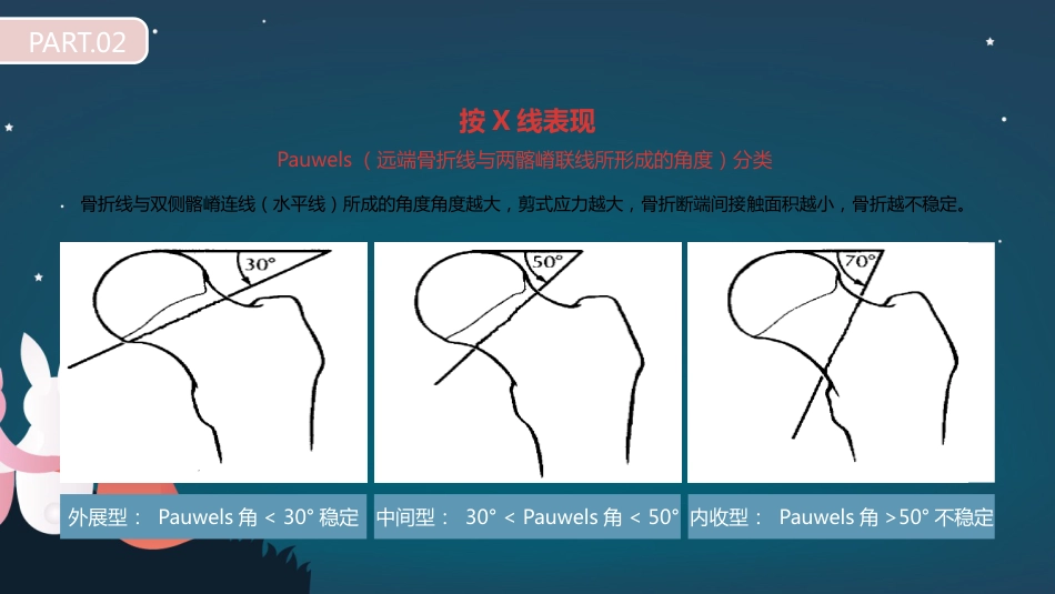 股骨胫骨折护理查房_第14页
