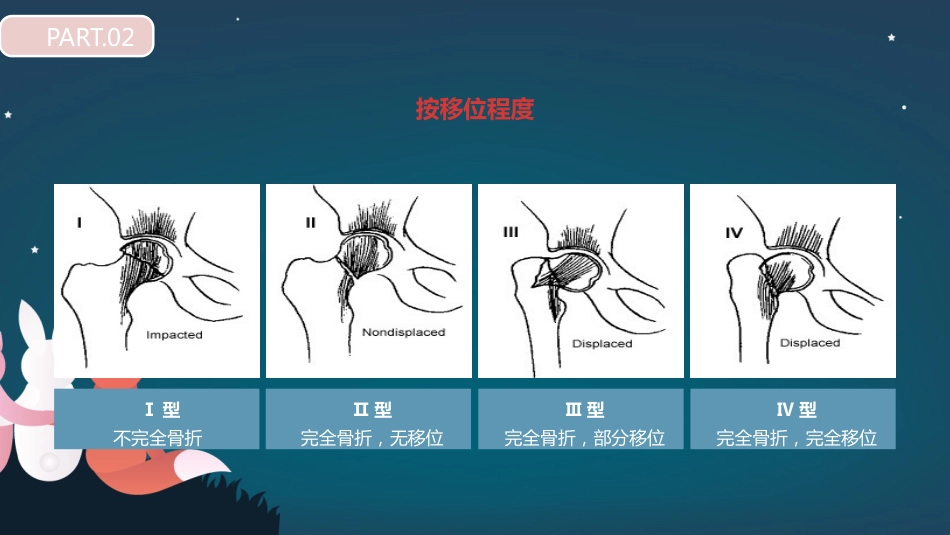 股骨胫骨折护理查房_第15页