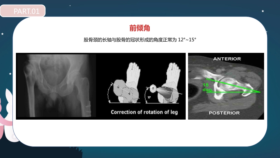 股骨胫骨折护理查房_第8页