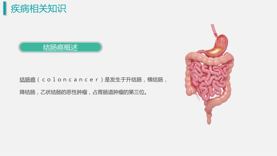 结肠癌 护理查房_第4页