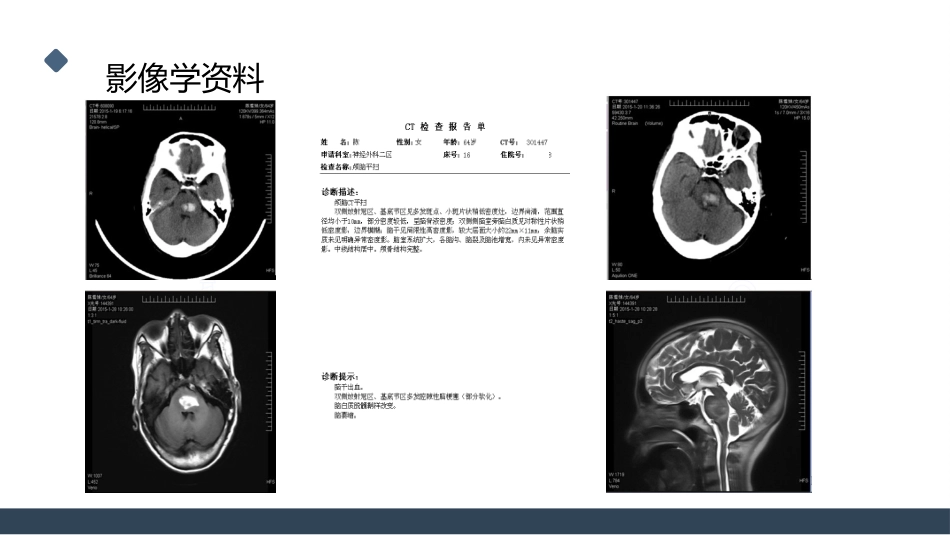 一例桥脑出血的护理个案分享_第10页