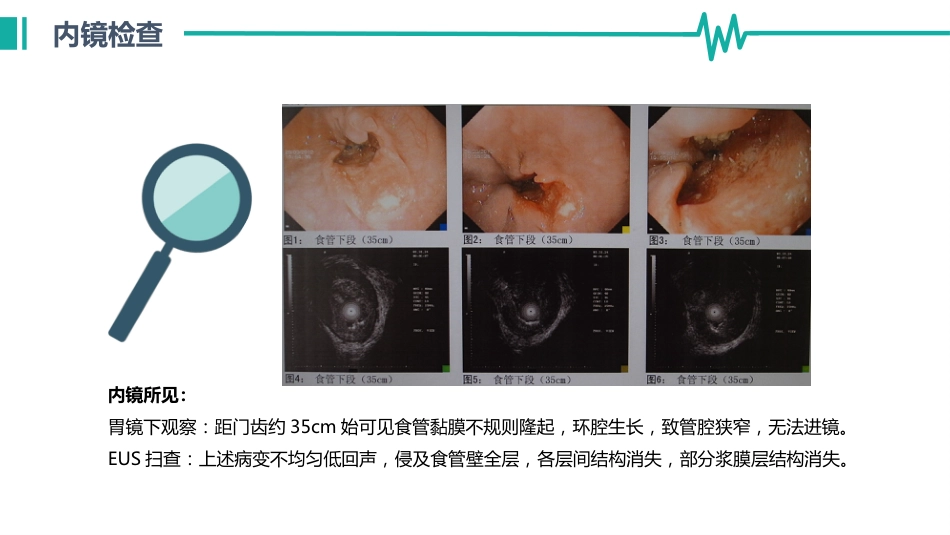 医院病历汇报通用模板_第12页
