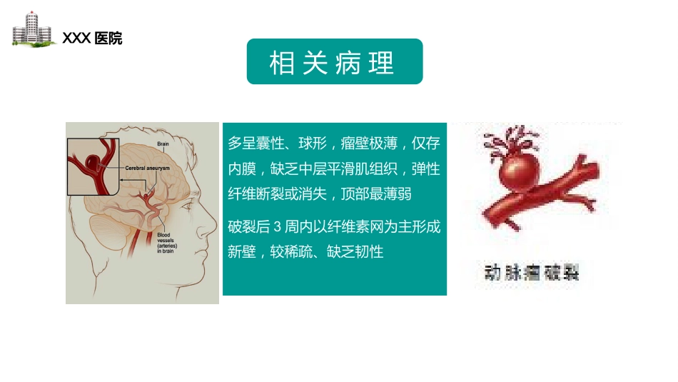 颅内动脉瘤病人的护理_第13页