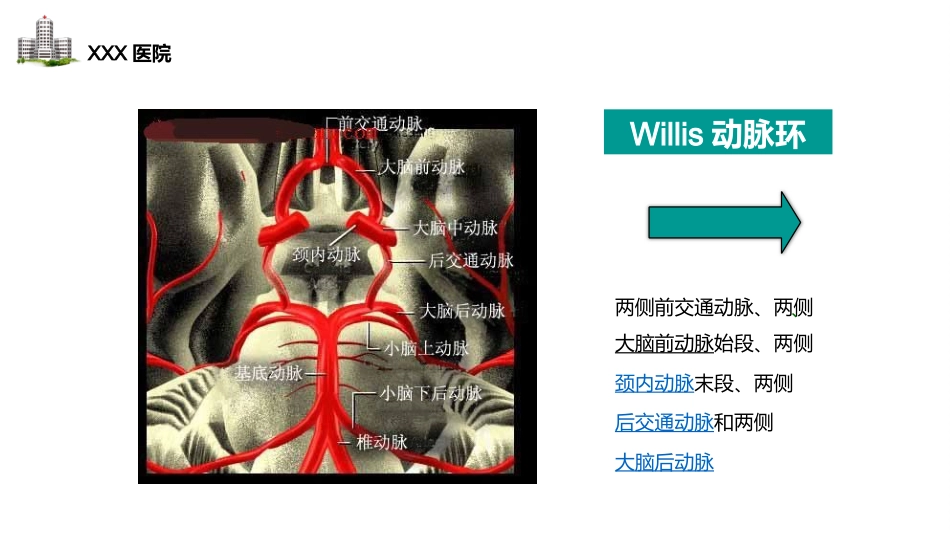 颅内动脉瘤病人的护理_第9页