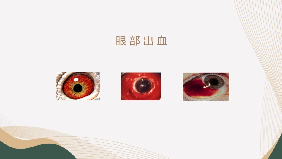 血液透析并发症-眼部护理_第10页