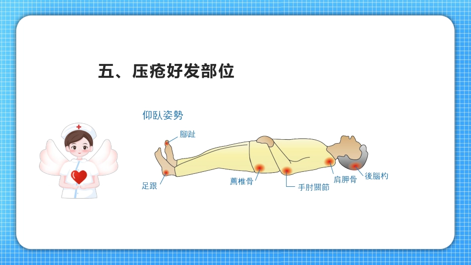 压疮护理查房_第10页