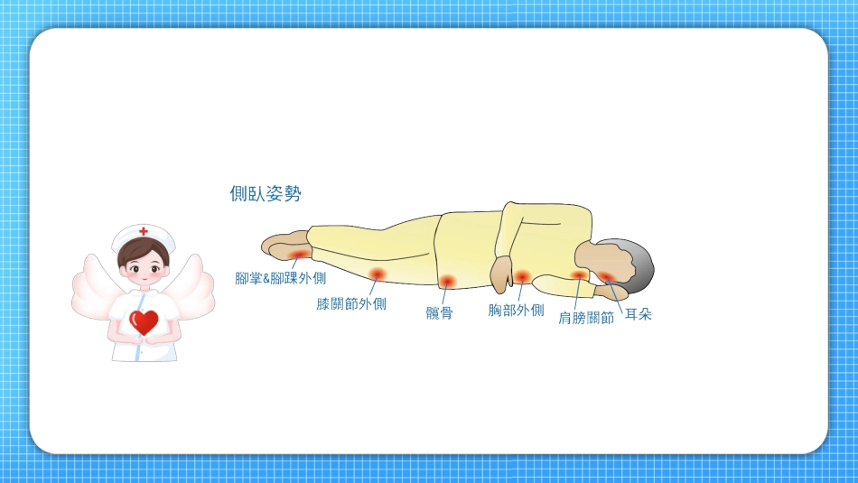 压疮护理查房_第11页