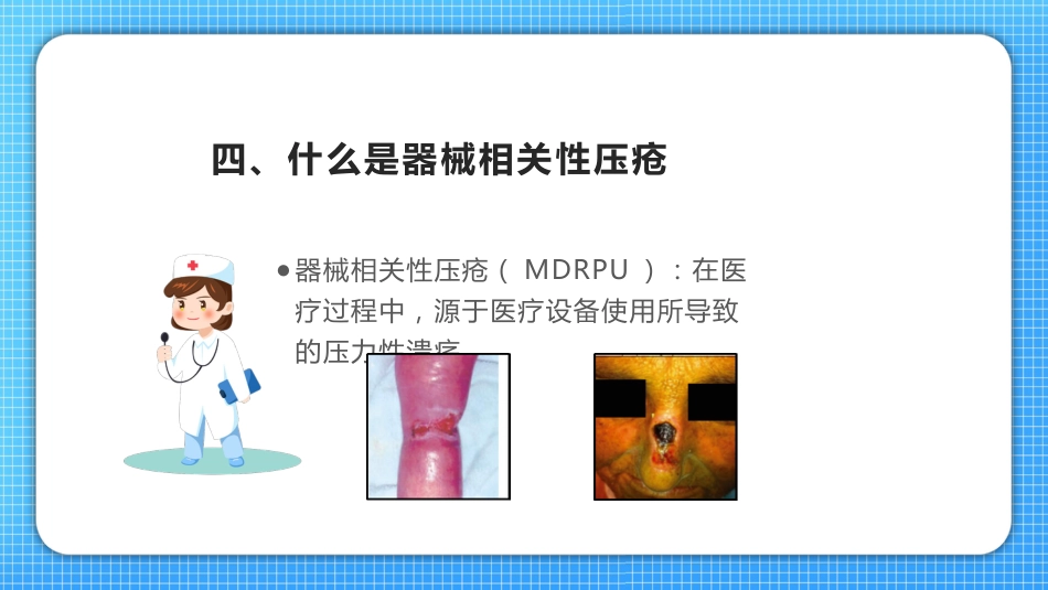 压疮护理查房_第8页