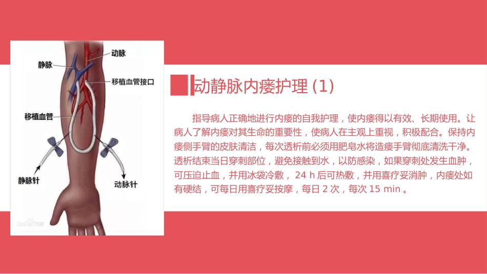 血透病人的护理_第15页