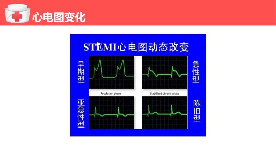 心肌梗塞个案护理（1）_第10页
