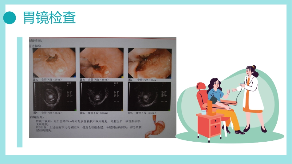 病例报告汇报3PPT_第13页