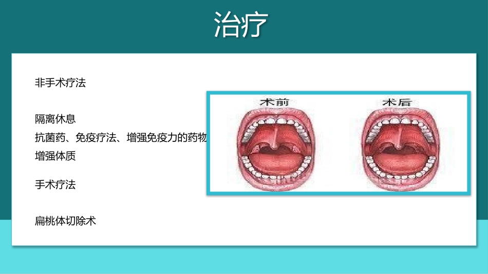 扁桃体炎护理查房PPT_第10页