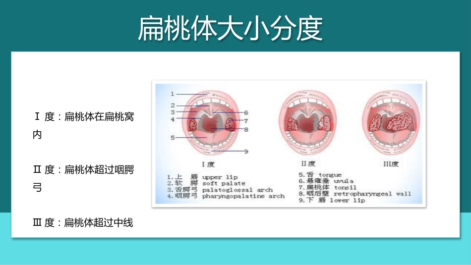 扁桃体炎护理查房PPT_第8页