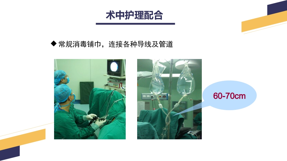 经尿道前列腺电切手术配合_第12页