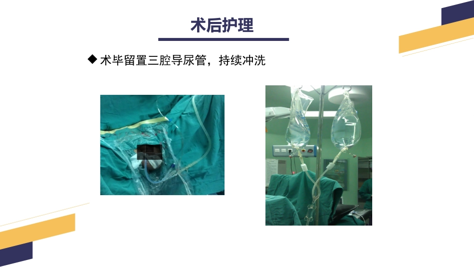 经尿道前列腺电切手术配合_第15页
