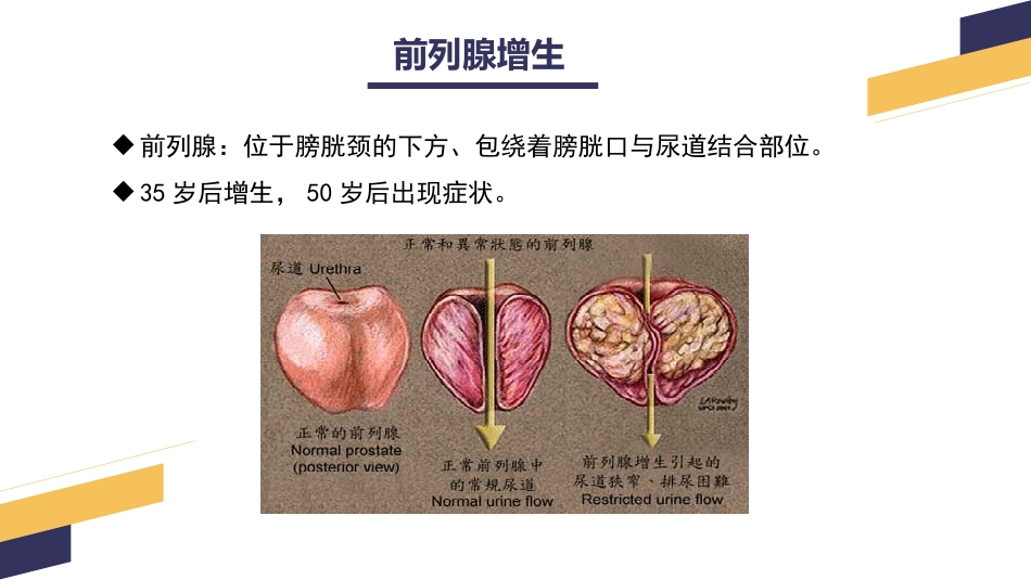 经尿道前列腺电切手术配合_第4页