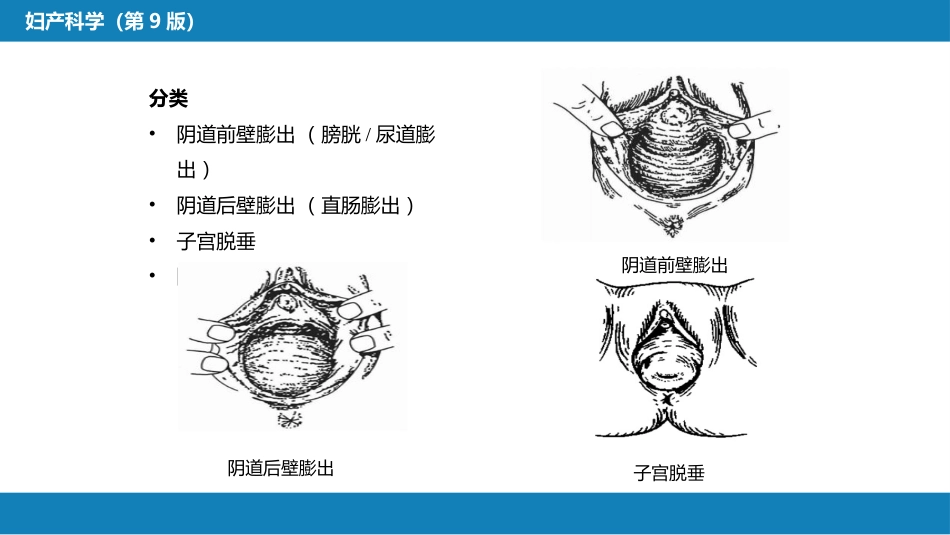 盆底功能障碍性及生殖器损伤疾病._第10页