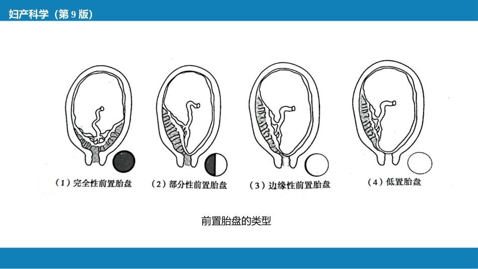 胎儿附属物异常._第9页