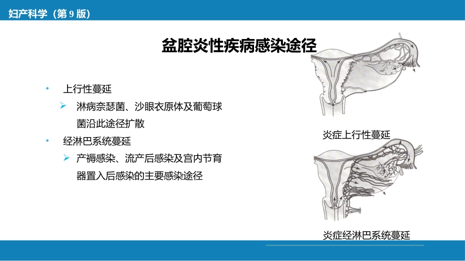 盆腔炎性疾病及生殖器结核_第11页