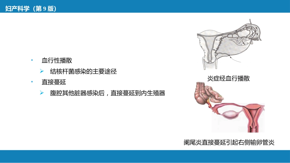 盆腔炎性疾病及生殖器结核_第12页