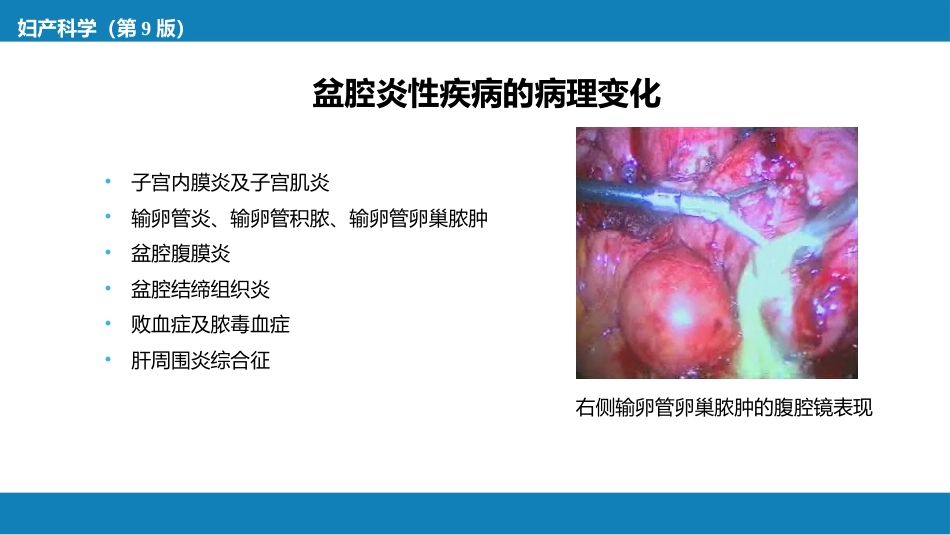 盆腔炎性疾病及生殖器结核_第14页