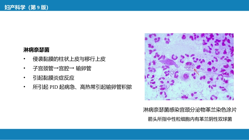 盆腔炎性疾病及生殖器结核_第8页
