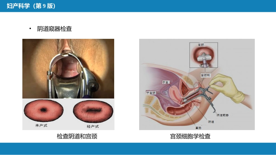 妇科病史及检查_第14页