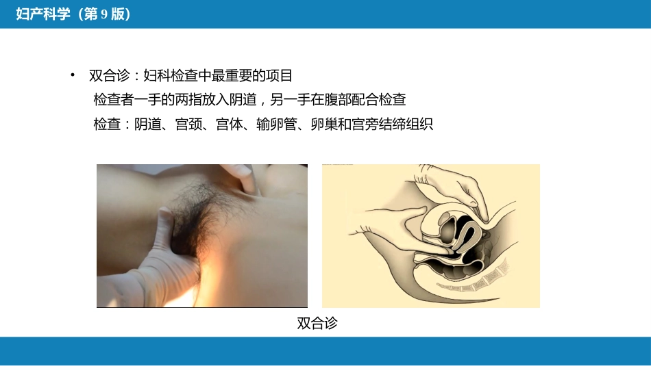 妇科病史及检查_第15页