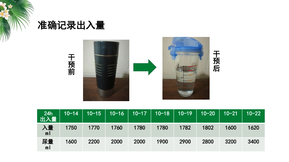 一例双腔ICD植入术合并心力衰竭患者的护理_第15页