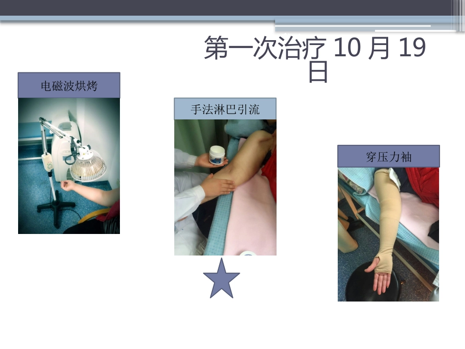 淋巴水肿的护理体会_第10页