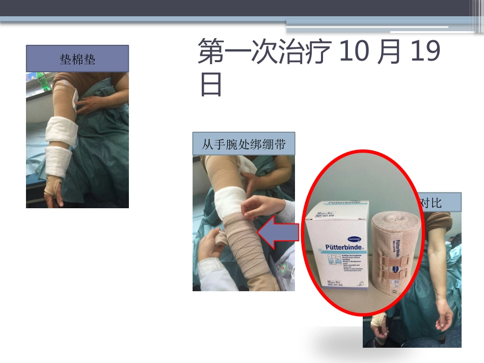 淋巴水肿的护理体会_第11页