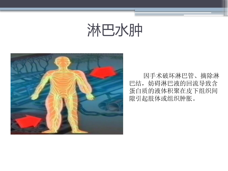 淋巴水肿的护理体会_第3页