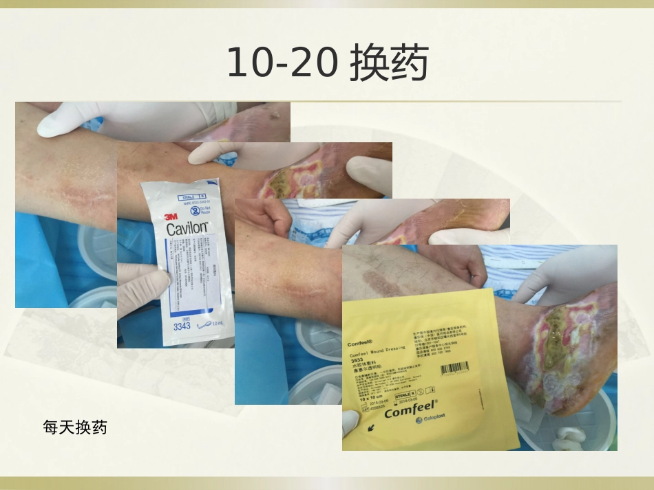 一例糖尿病合并足部外伤患者的护理_第13页