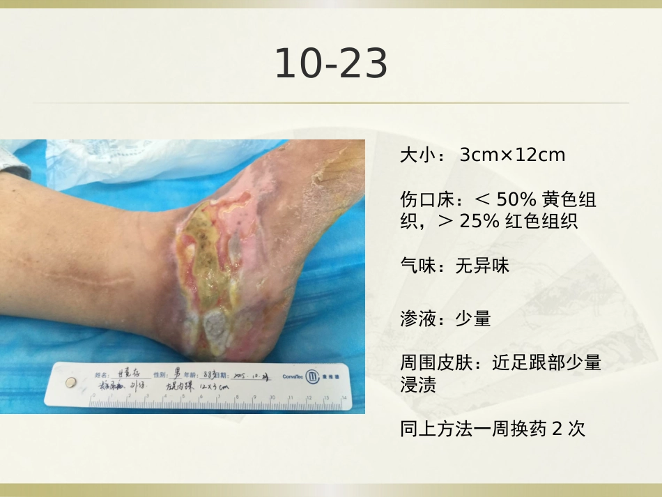 一例糖尿病合并足部外伤患者的护理_第14页