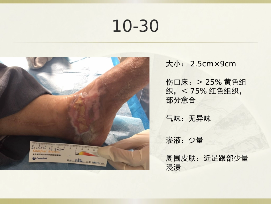一例糖尿病合并足部外伤患者的护理_第15页