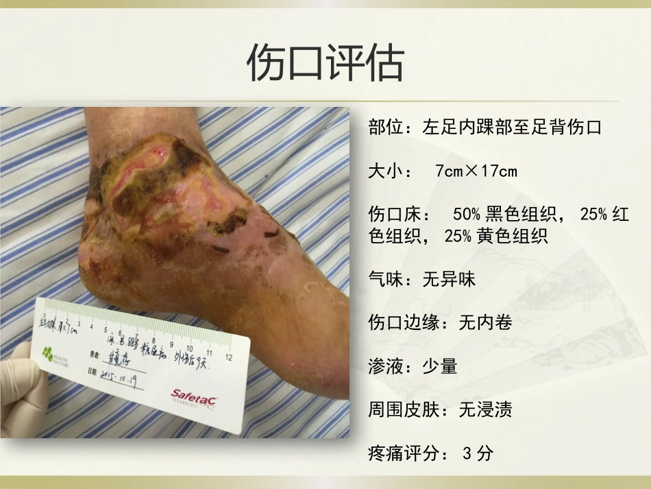 一例糖尿病合并足部外伤患者的护理_第7页