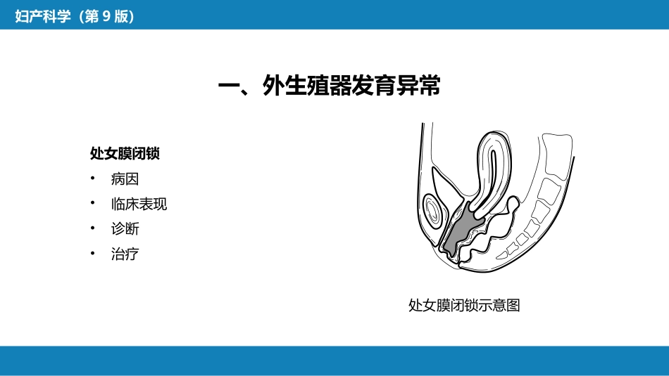 女性生殖器发育异常_第12页
