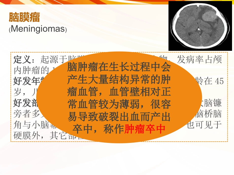 一例肿瘤卒中患者的护理_第3页