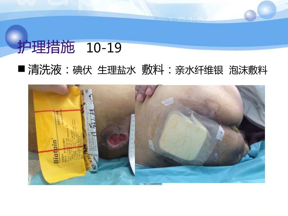 一例糖尿病合并骶尾部压疮患者的护理_第10页