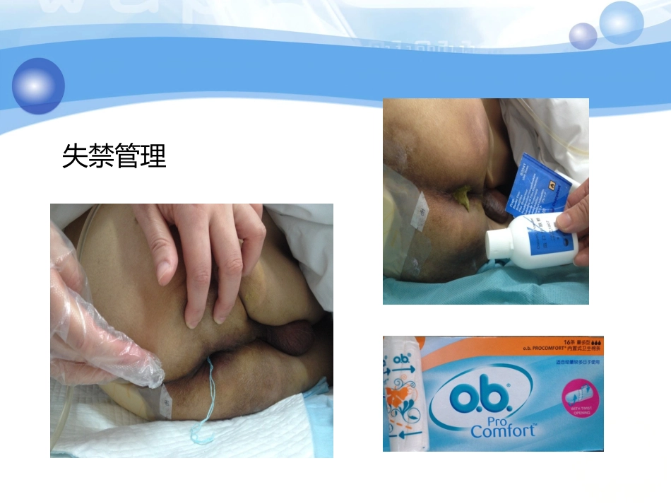 一例糖尿病合并骶尾部压疮患者的护理_第11页